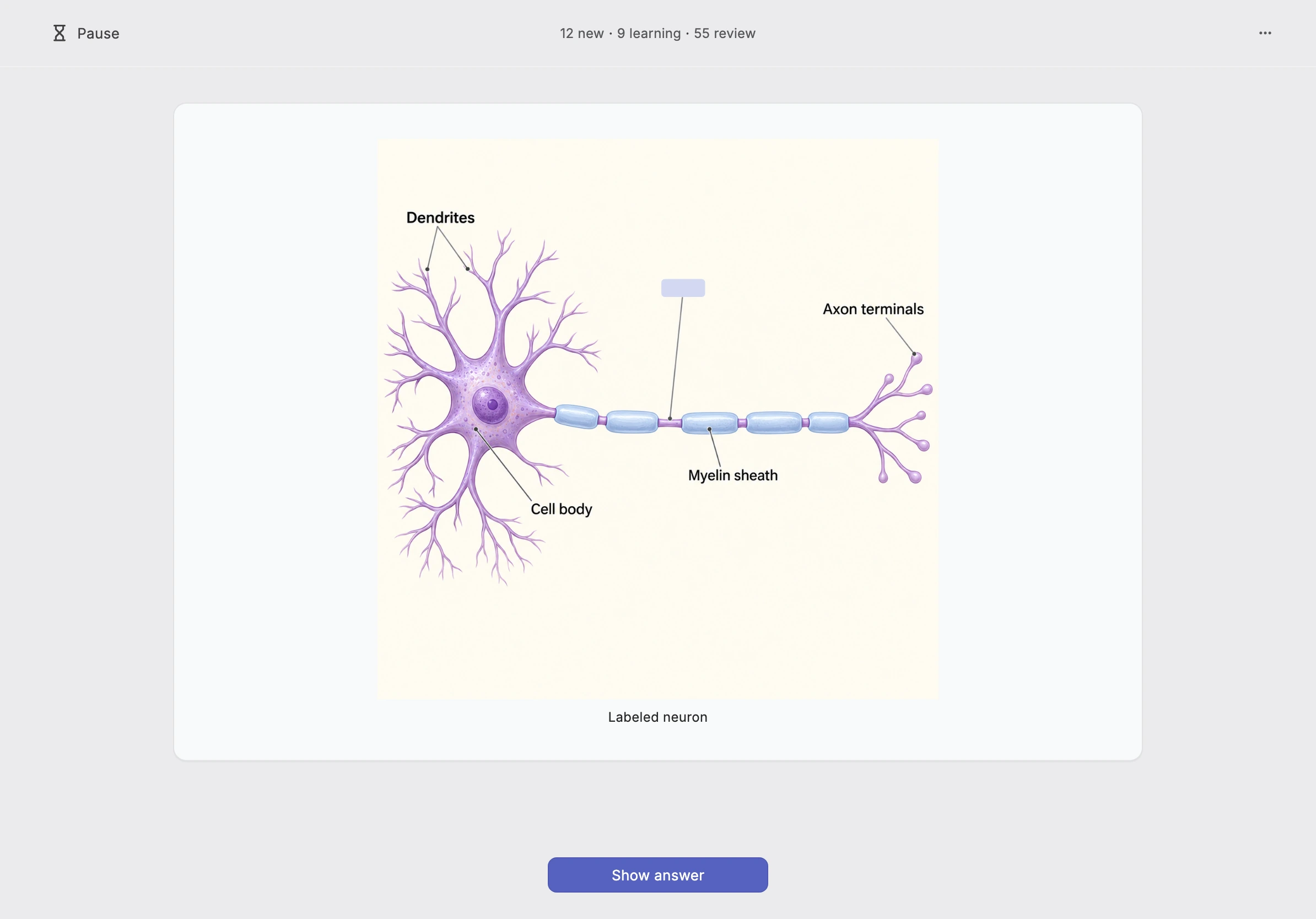 Cortex Study on a landscape iPad, showing a labeled neuron with one label covered.